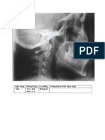 Cephalogram For OP Sem 1