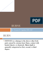 Burns: By: Rosario B. Aguilar, BSN, RN