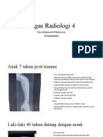 Reza Natanael Widyawono (Tugas Radiologi 4)