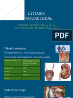 LITIASIS RENOURETERAL