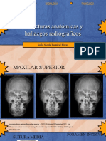 Estructuras Anatomicas y Hallazgos Radiograficos