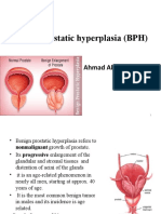 Benign Prostatic Hyperplasia (BPH) : Ahmad Abdulraheem