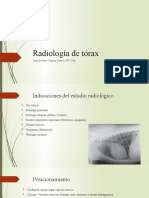 Radiología de tórax: Patrones pulmonares y mediastino