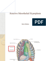Reactive Mesothelial Hyperplasia: Rawa Muhsin