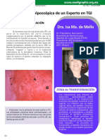 ZONA DE TRANFORMACION EN COLPOSCOPIA - Dra. Isa Ma. de Mello
