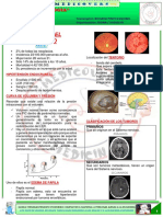 Neurologia 9 Tumores Del Endefalo Medicovers