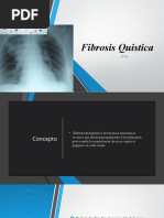 FIBROSIS