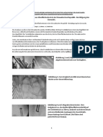 Analyse Von Teststäbchen Aus Oberflächentests in Der Slowakischen Republik - Bestätigung Des Genozids