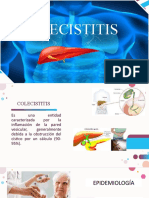 Colescistitis: causas, síntomas y tratamiento