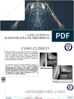 Diapositivas Caso Clinico
