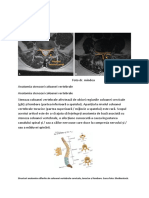 stenoza de canal vertebral