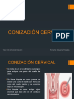 Conización Cervical