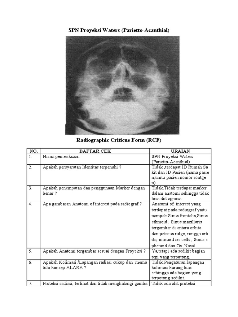Evaluasi Proyeksi Waters SPN Radiografi | PDF