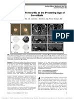 Isolated Optic Perineuritis As The Presenting Sign of Sarcoidosis