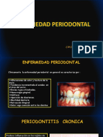 Enfermedades periodontales