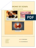 Síndrome de Down