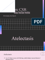Pathologic CXR: Atelectasis, Pleural Effusion, Pneumothorax