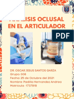 Análisis oclusal en articulador