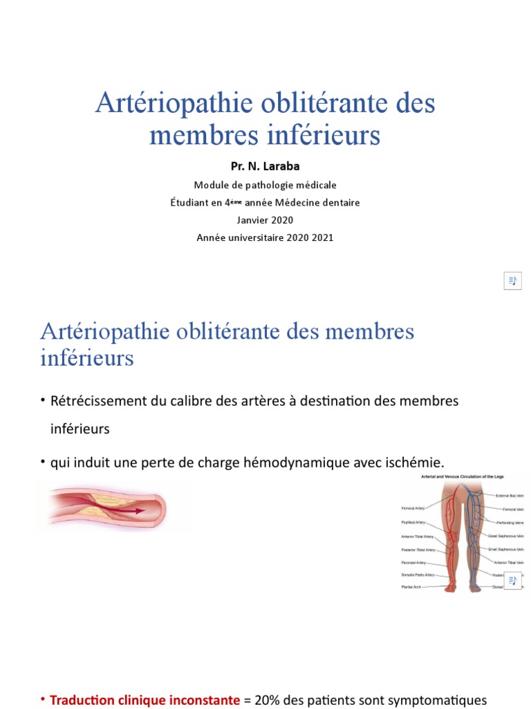 pathologie-vasculaire-art-riopathie-oblit-rante-des-membres-inf-rieurs