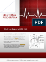 ECG