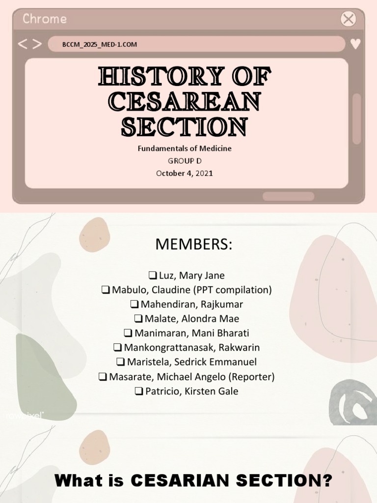 History of Cs PDF Caesarean Section Childbirth