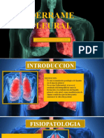 Derrame Pleural