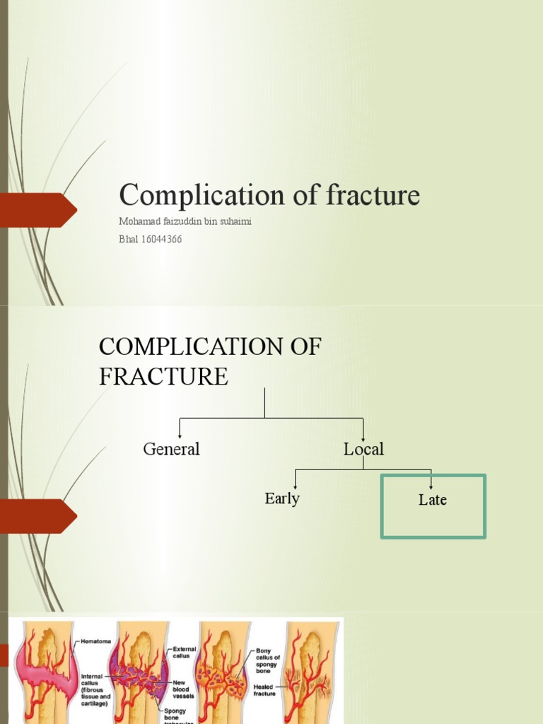 Complications of Fracture Healing | PDF | Bone | Surgical Specialties