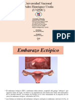 Embarazo Ectópico: Diagnóstico y Manejo