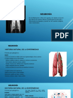 6.1.12 Neumonía