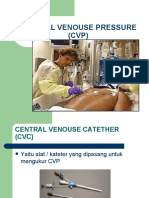 PTM 6-CVC Dan CVP