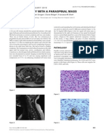 0210case1Hodgkins