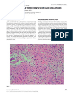 0410case1 GBM With PNET