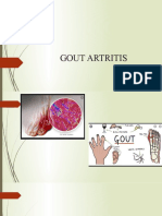 Gout Artritis