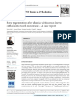 Bone Regeneration After Alveolar Dehiscence Due To Orthodontic Tooth Movement - A Case Report