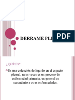 POWER Derrame Pleural