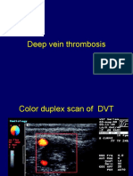 2 Deep Vein Thrombosis