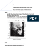 CEPHALOMETRI EKSTRAOral