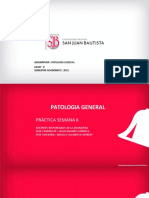 Patología General: Pólipo Endometrial