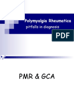 Polymyalgia Rheumatica: Pitfalls in Diagnosis