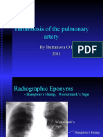 Thrombosis of The Pulmonary Artery: by Butranova O.I. 2011