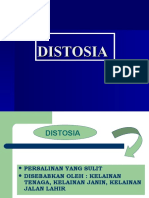 DISTOSIA Kelainan His