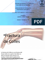 Fractura de Colles