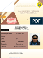 Caso Clinico Protesis Total I MOD