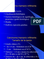 Carcinoma Infiltrante de Glándula Mamaria