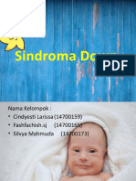 Sindroma Down Bindo