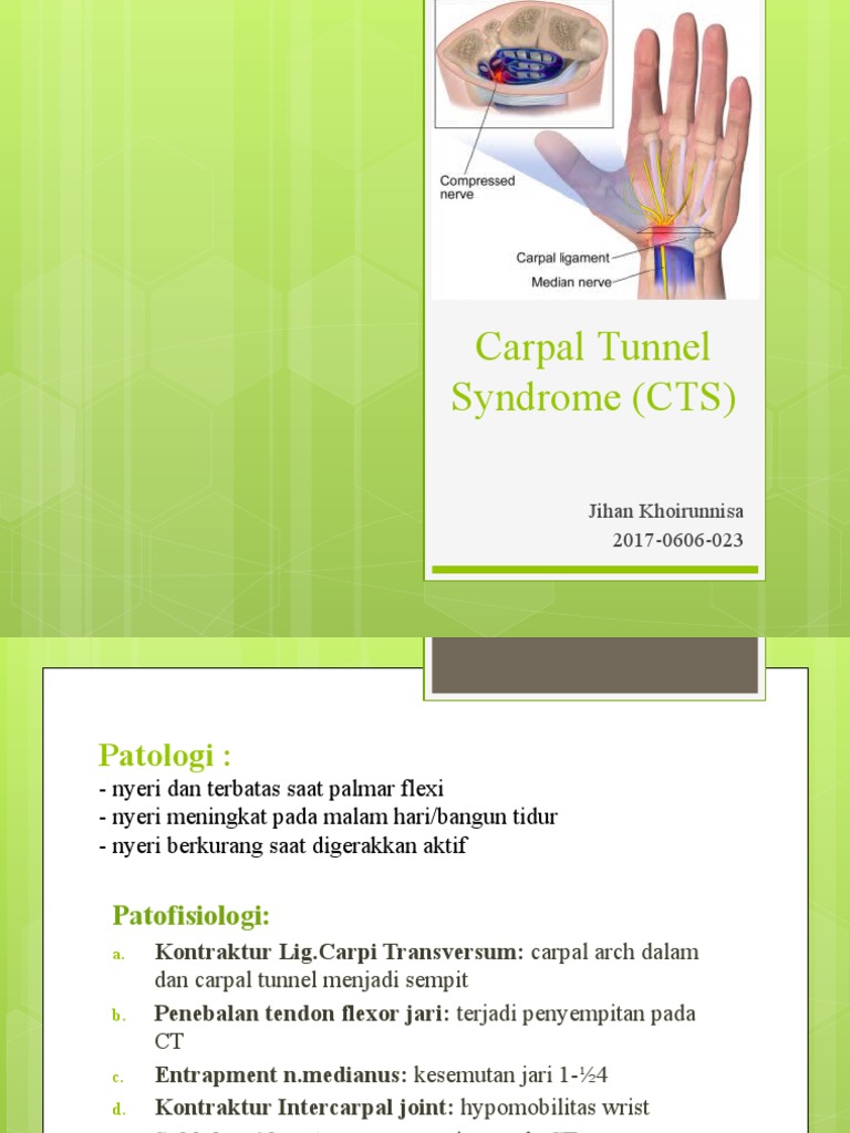 Panduan Lengkap Carpal Tunnel Syndrome | PDF | Sains & Matematika