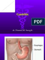Gastritis PPT