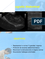 Ultrasonografía Abdominal - Higado-Vesicula Biliar
