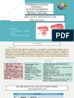 Caso y Revisión de Hiperplasia Benigna de Prostata