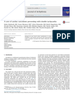 Journal of Arrhythmia: Case Report